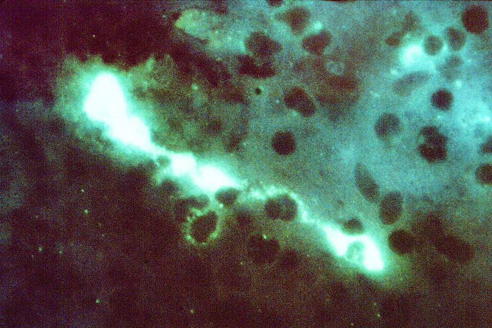 Fayl:Chlamydophila psittaci FA stain.jpg