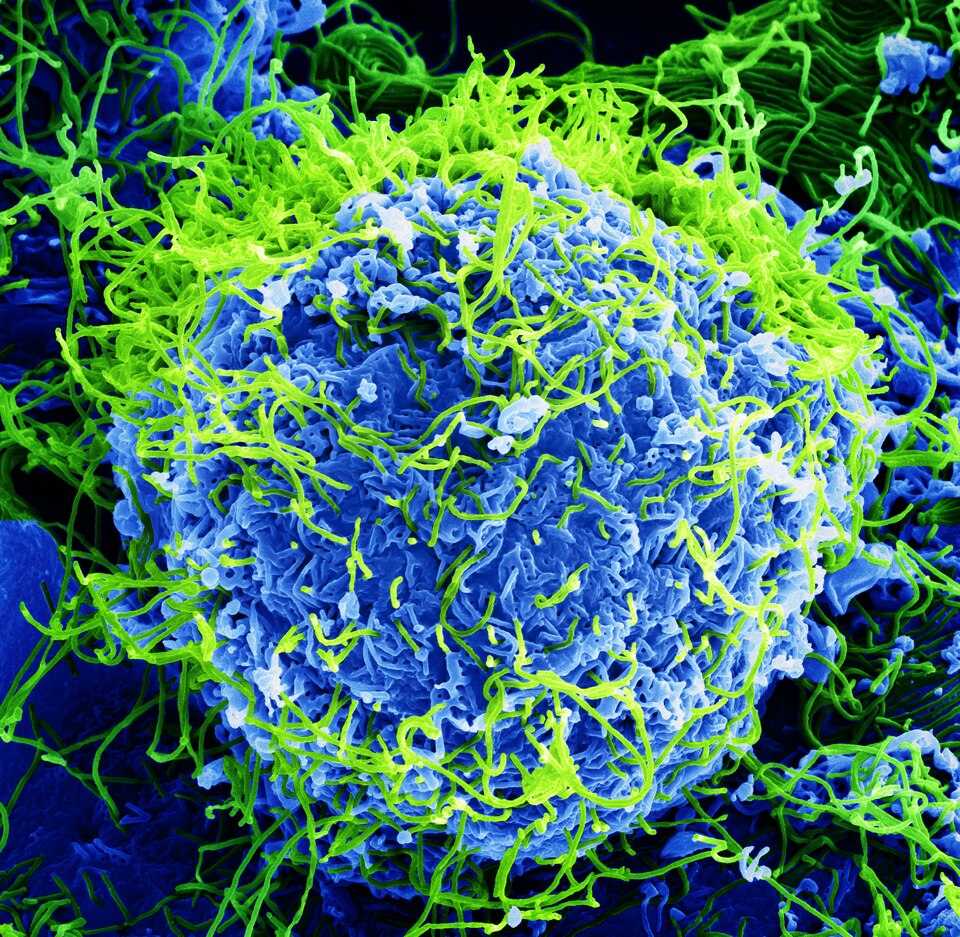 Fayl:Ebola Virus - Electron Micrograph.tiff