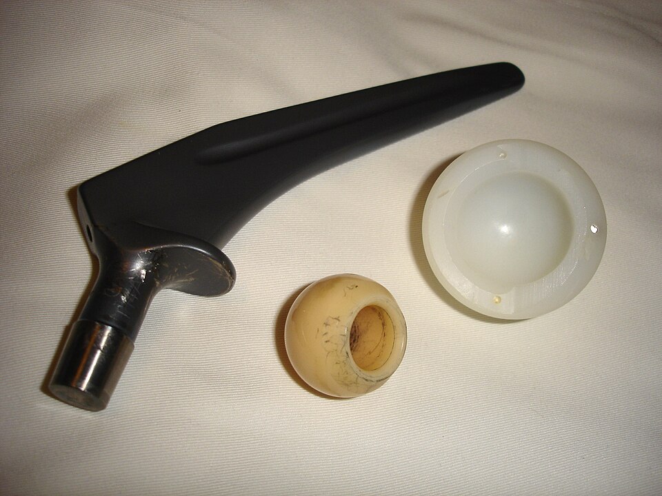 Fayl:Hip prosthesis.jpg