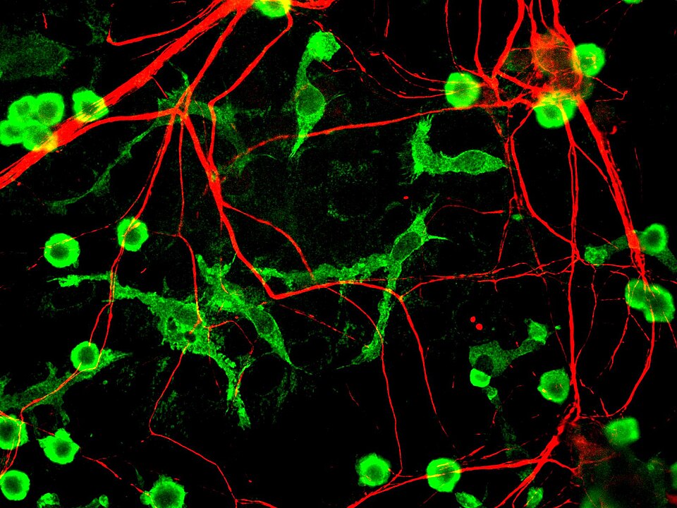 Fayl:Microglia and neurons.jpg