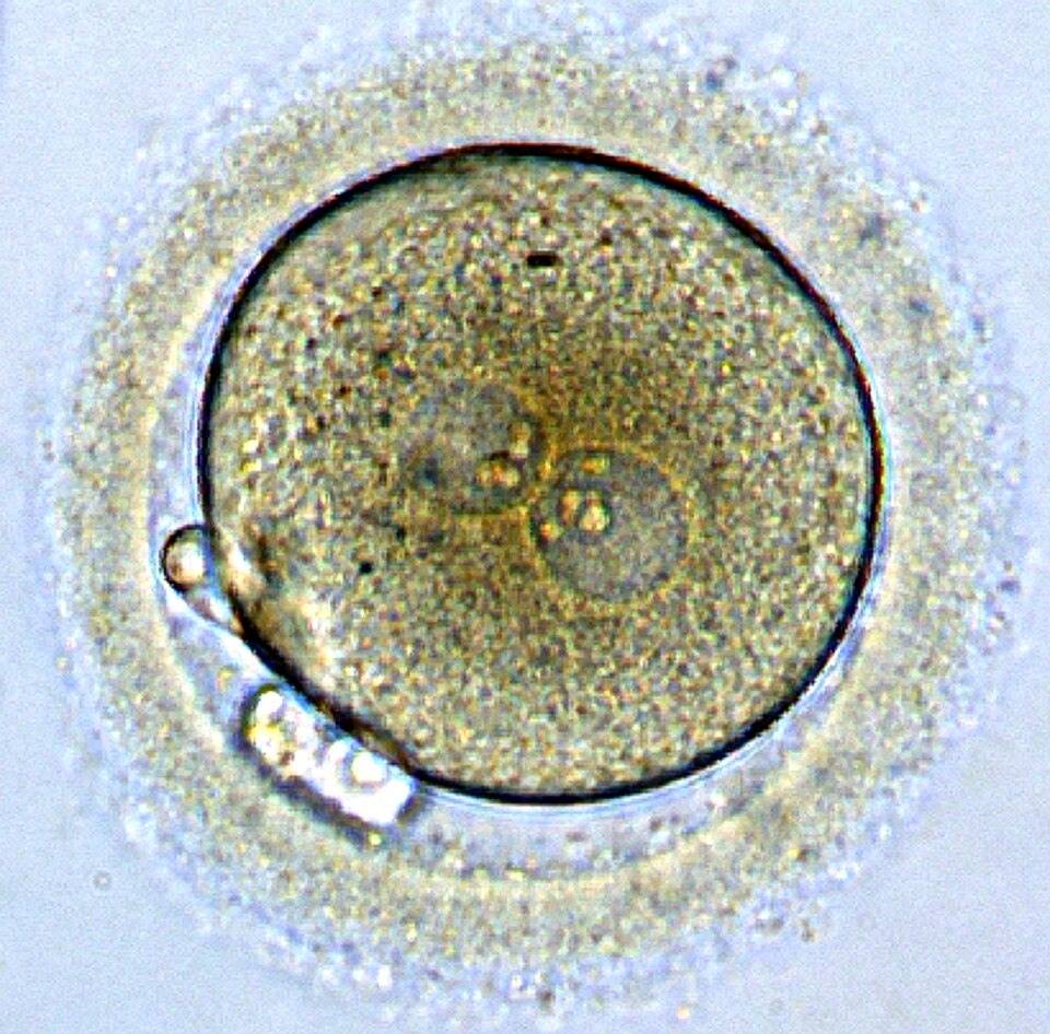 Fayl:Zygote.tif