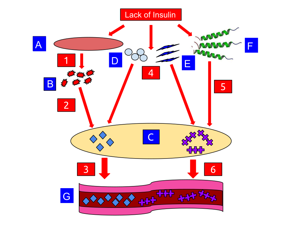 Fayl:Diabetic Ketoacidosis Model.svg