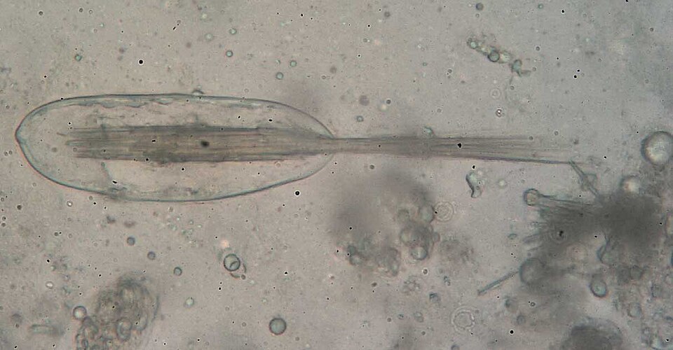 Fayl:Raphides in idioblast.jpg