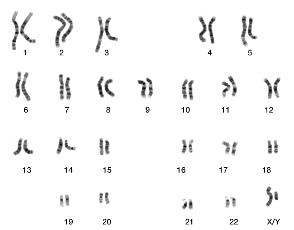 Fayl:DNA human male chromosomes.gif