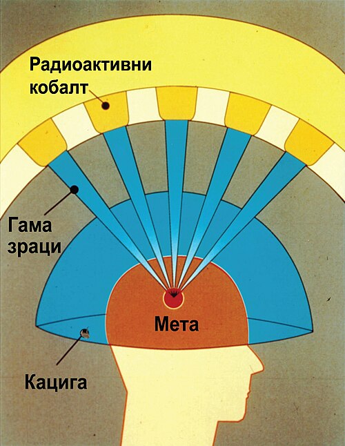 Fayl:Gamma Knife Graphic-sr.jpg