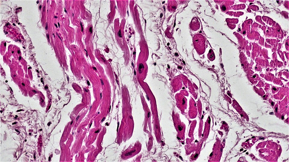 Fayl:Muscle Tissue Cardiac Muscle (28184528408).jpg