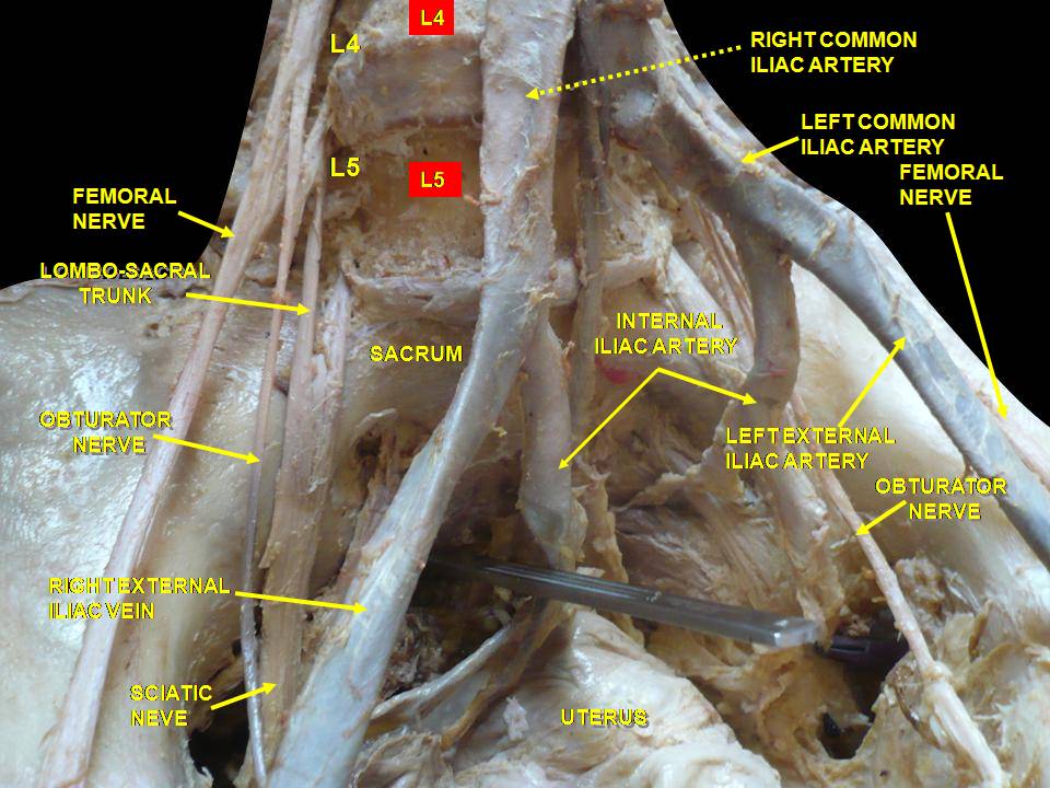 Fayl:Slide3erer.JPG