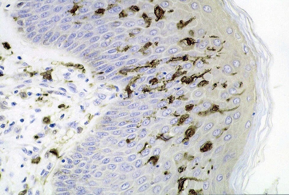 Fayl:Dendritic cells.jpg