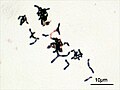 Bifidobacterium adolescentis