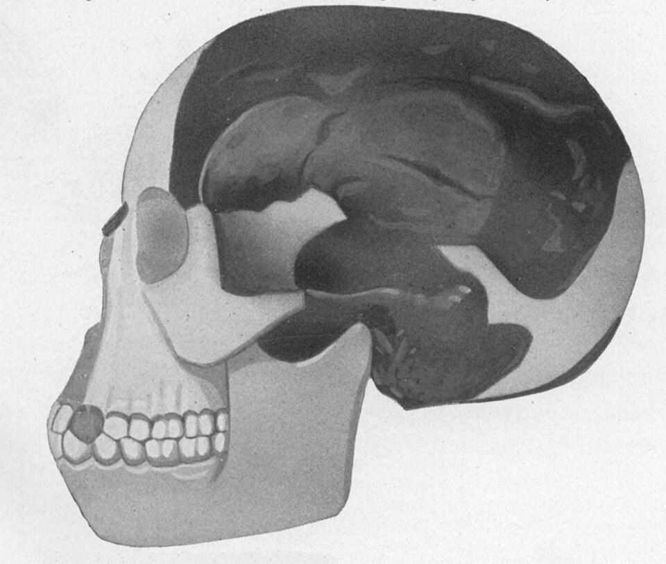 Fayl:Piltdown man.jpg