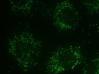 Peroxisome in rat neonatal cardiomyocyte staining The SelectFX Alexa Fluor 488 Peroxisome Labeling Kit directed against peroxisomal membrane protein 70 (PMP 70)