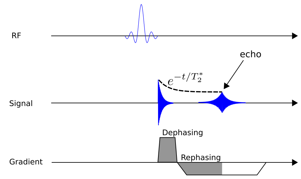Fayl:Gradient echo MRI.svg