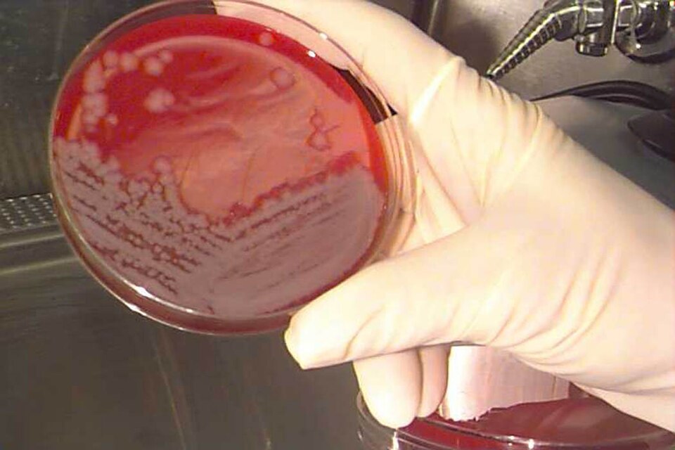 Fayl:Anthrax culture.jpg