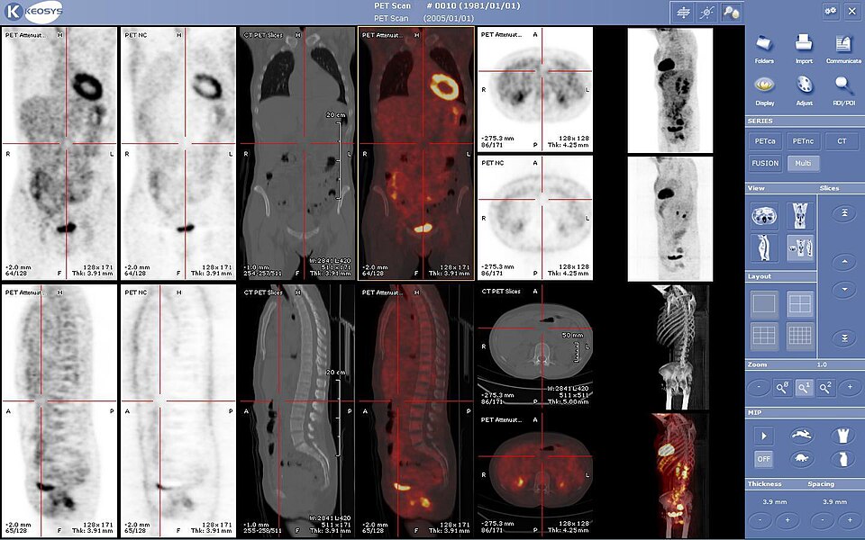 Fayl:Viewer medecine nucleaire keosys.JPG