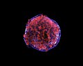 Tycho Supernova rentgen nurida