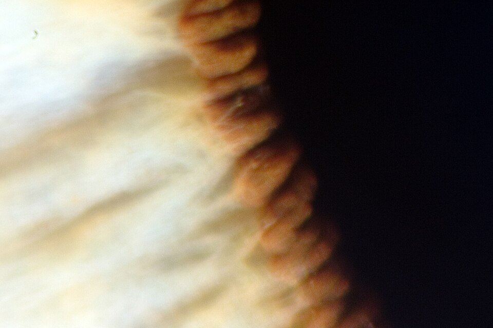 Fayl:Iris Dilator Muscle 012909.jpg