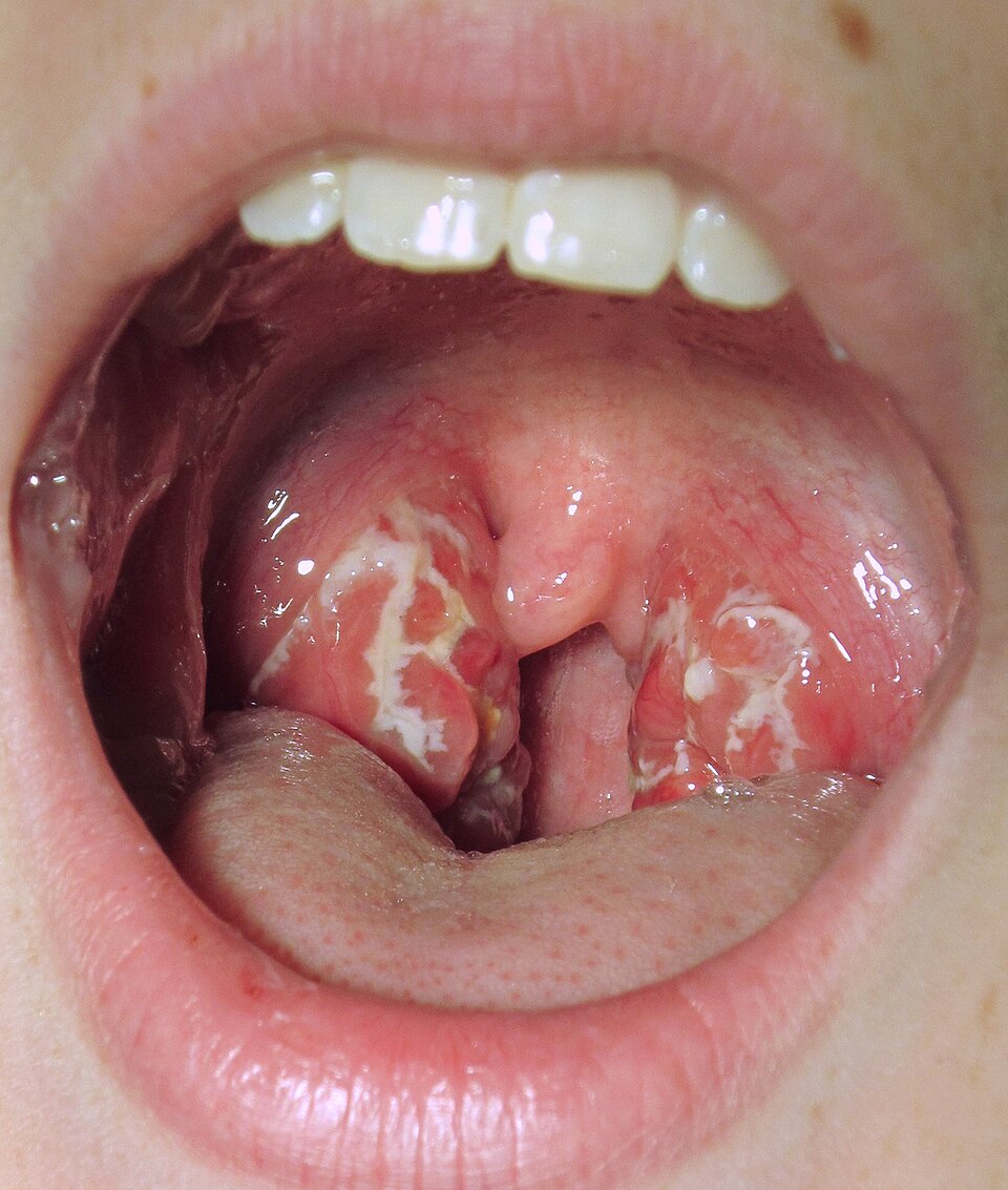 Fayl:Pos strep.JPG