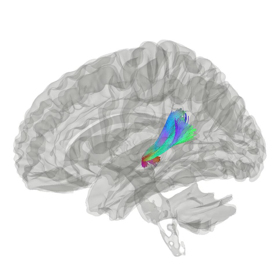 Fayl:Acoustic Radiation.jpg