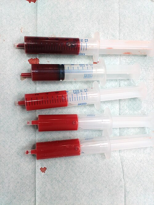 Fayl:Venous and arterial blood.jpg