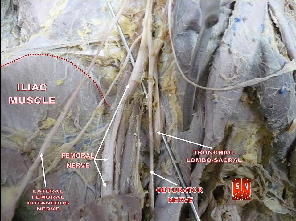 Fayl:Branches of lumbar plexus.jpg