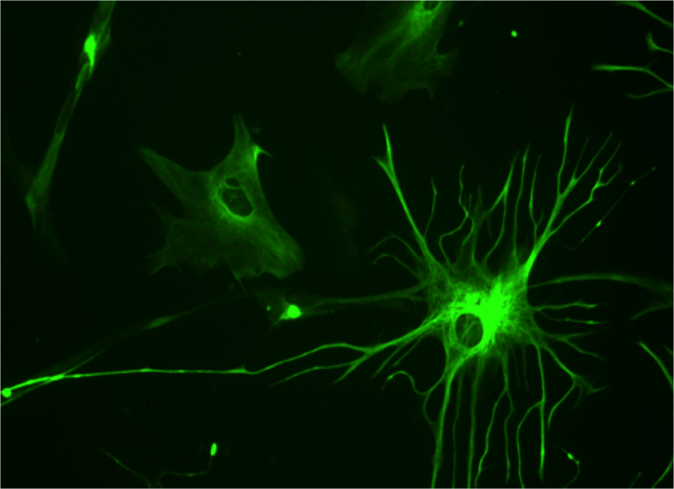 Fayl:Human astrocyte.png