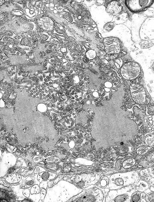 Fayl:Rabies Virus EM PHIL 1876.JPG