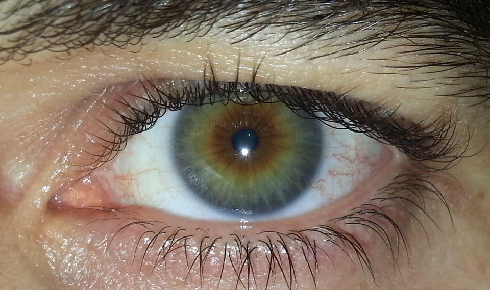 Fayl:Hazel eye1.png