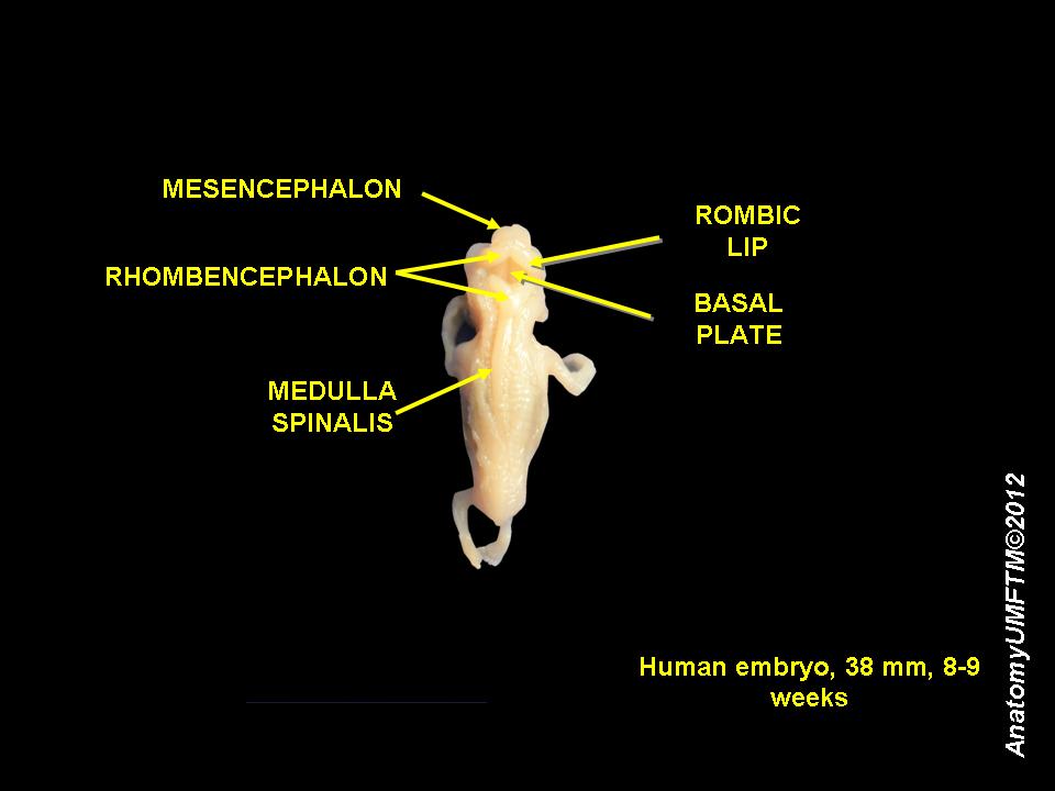 Fayl:Human embryo 8 weeks 6.JPG