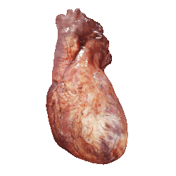 Kompyuter tomografiyada tasvirlangan yurakning 3D modeli