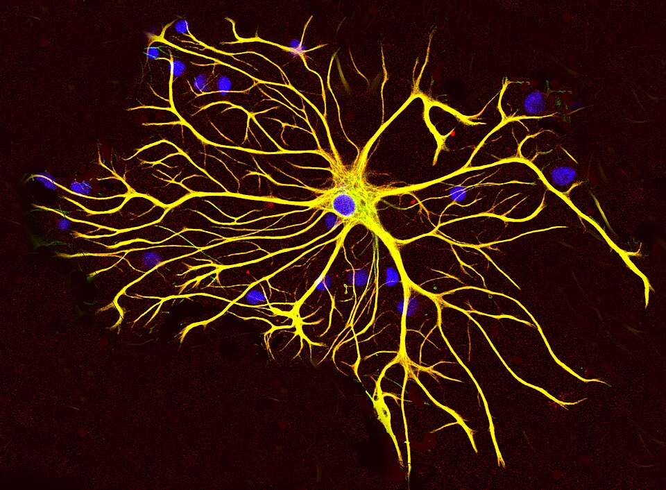 Fayl:Astrocyte5.jpg