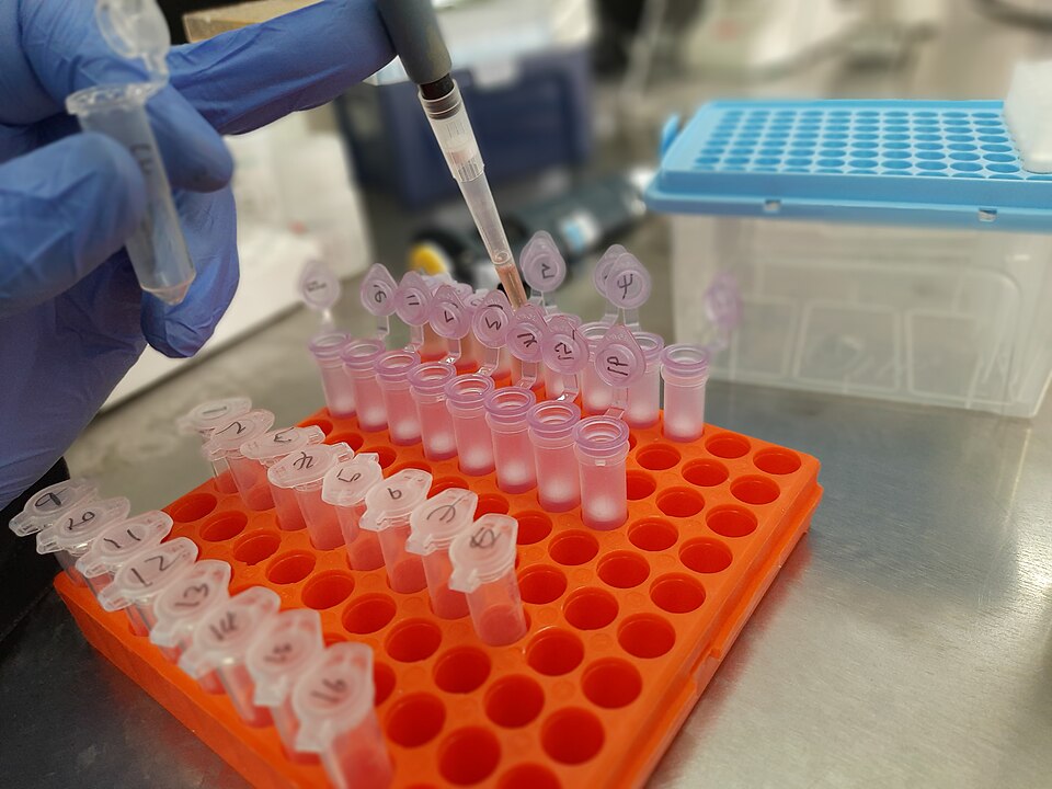 Fayl:DNA Extraction of Bacteria.jpg