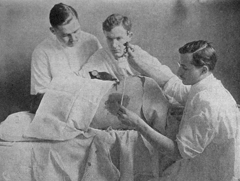 Fayl:Meningitis - Lumbar puncture.jpg