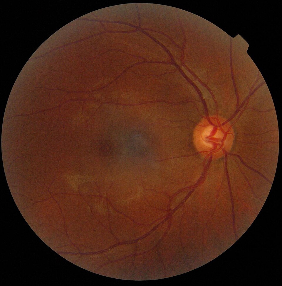 Fayl:Retinography.jpg