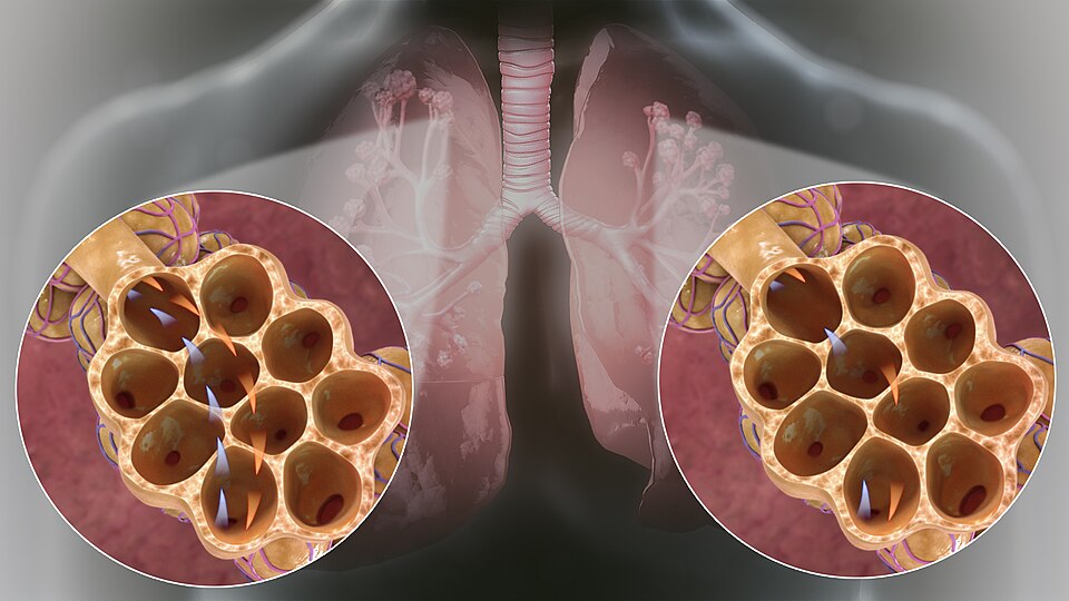 Fayl:Hyperventilation vs Hyperpnea.jpg
