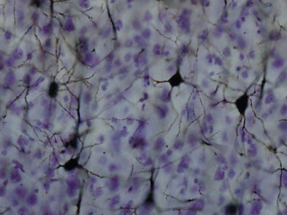 Fayl:NeuronGolgi.png
