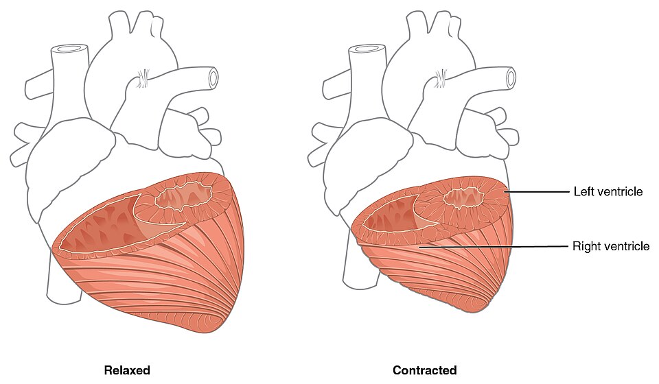 Fayl:2007 Ventricular Muscle Thickness.jpg