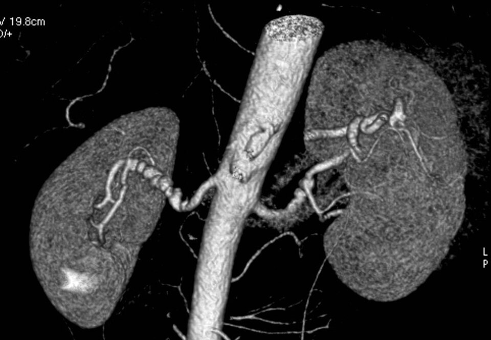 Fayl:CTA FMD.jpg