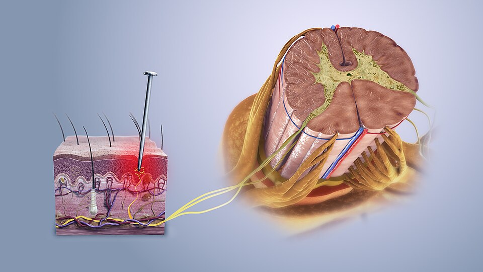 Fayl:Nociceptive pain.jpg