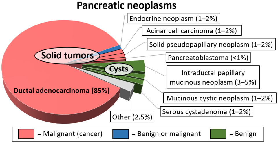 Fayl:Relative incidence of pancreatic neoplasms.png