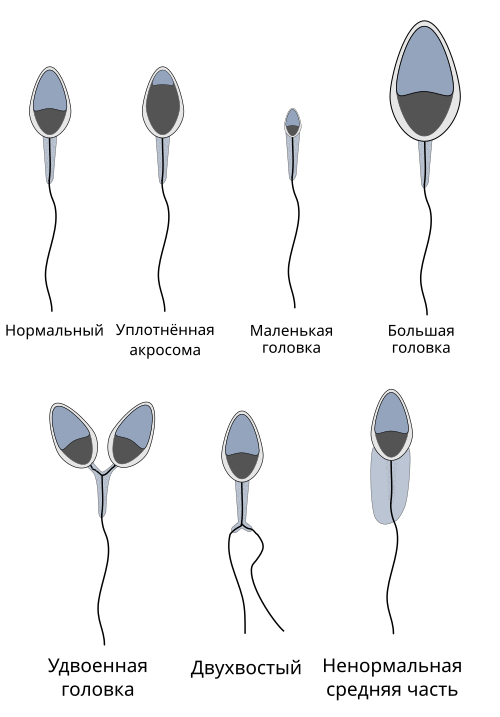 Fayl:Abnormalsperm-ru.svg