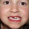 10:24, 2008-yil 27-mart dagi versiya uchun tasvir