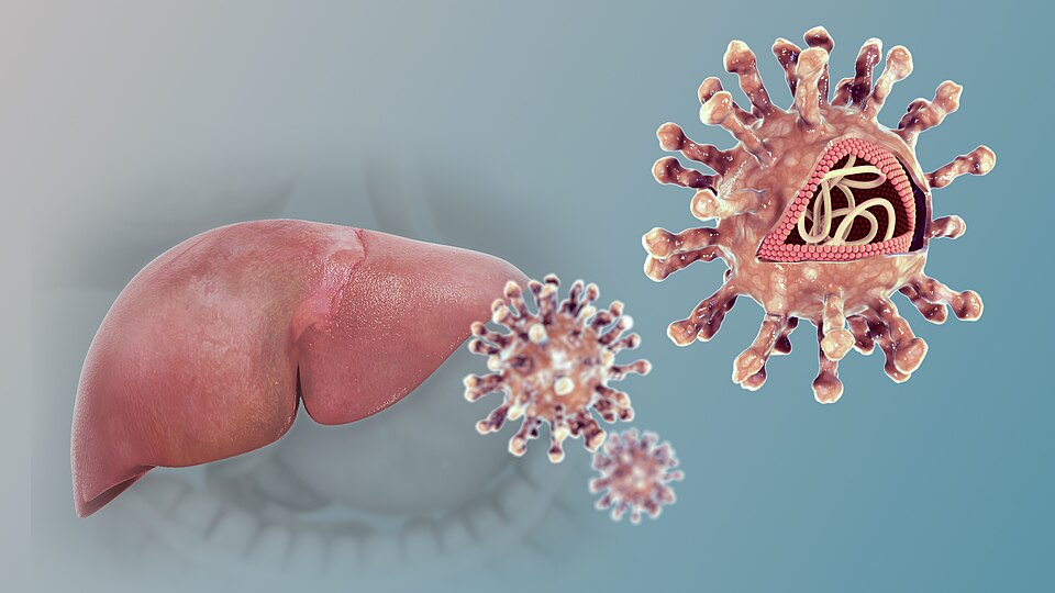 Fayl:Hepatitis C.jpg