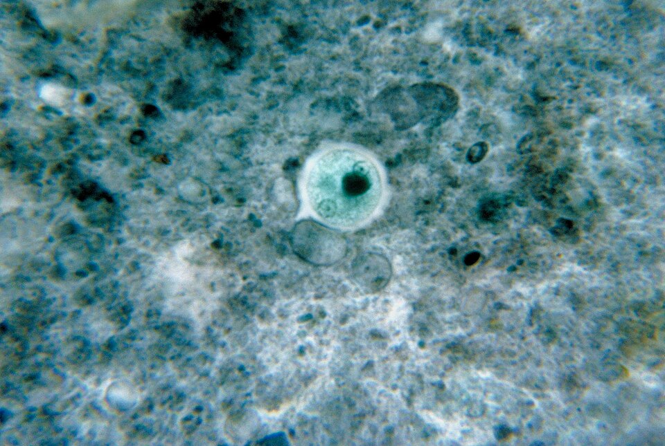 Fayl:Entamoeba histolytica 01.jpg