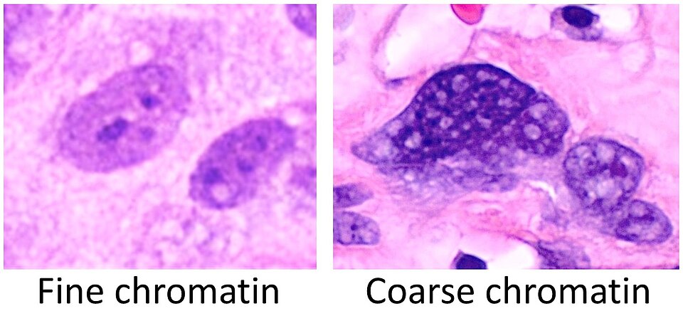 Fayl:Fine versus coarse chromatin.jpg