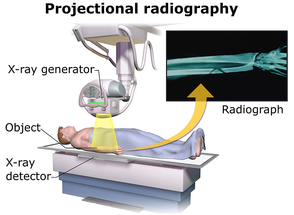 Fayl:Projectional radiography components.jpg