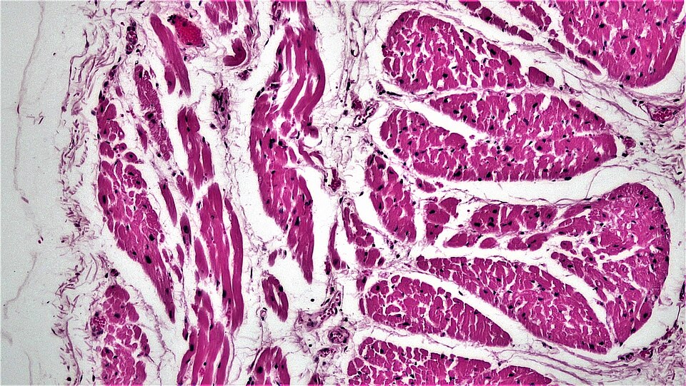 Fayl:Muscle Tissue Cardiac Muscle (27187637147).jpg