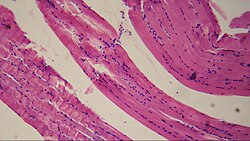 Smooth muscle (histology slide)