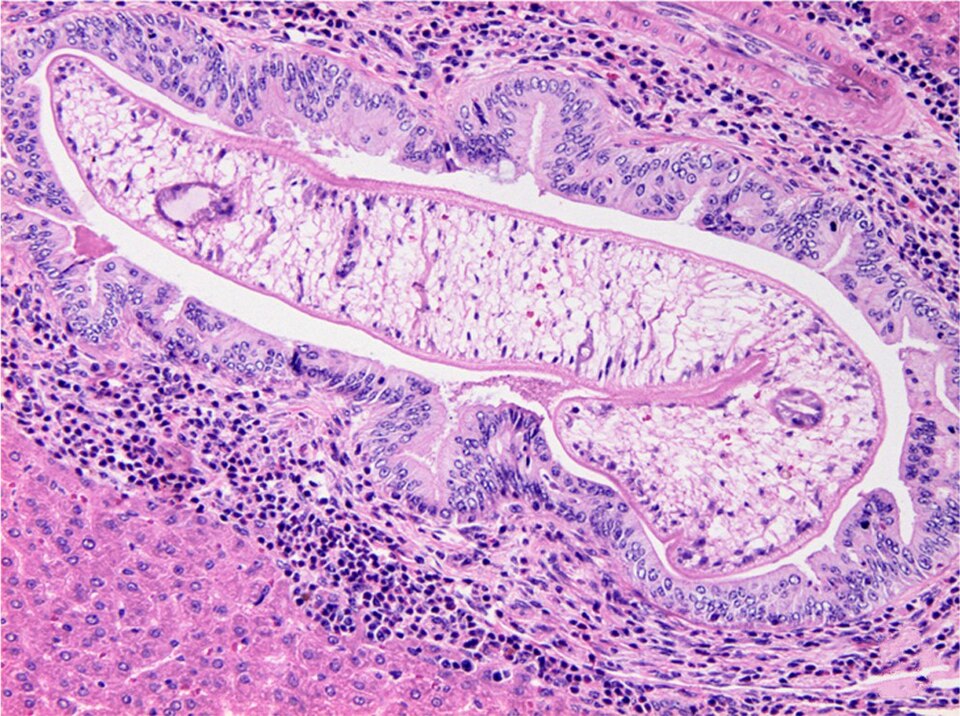 Fayl:Opisthorchis viverrini 2.jpg