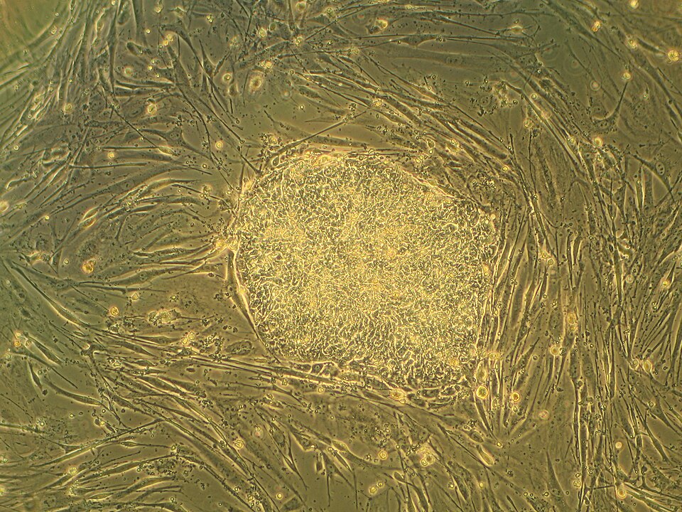 Fayl:Humanstemcell.JPG