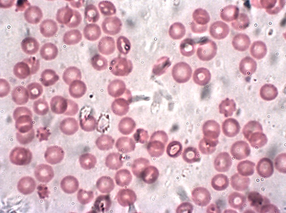 Fayl:Humanrbc1000x.jpg